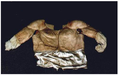 muscle artifact meaning muscle artifact meaning